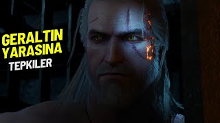 The Witcher 3 Geraltın Yarasına Tepkiler TrissCiriYenefer [upl. by Harhay]