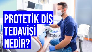 Protetik Diş Tedavisi Nedir Nasıl Yapılır [upl. by Dnanidref584]