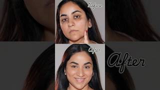 NO Foundation amp Concealer How to Cover Dark Circles Spots amp Scars [upl. by Llewkcor928]