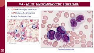 Hematology  2  U2L26  FAB classification of AML subtypes  5 [upl. by Ramat]