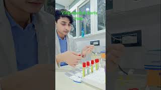 Viral marker test HCV HIV HBsAG VDRL bloodtestkaisehotahai bloodtest [upl. by Hort]