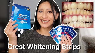 I TRIED THE CREST 3D WHITESTRIPS FOR 14 DAYS Effective  Before amp After pictures [upl. by Lambert587]