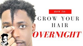 How To Grow Your Hair OVERNIGHT  WINSTONEE [upl. by Borrell]