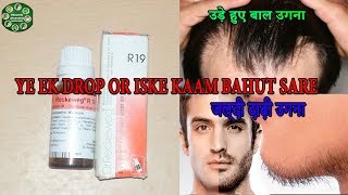 जल्दी दाढ़ी और उड़े हुए बाल उगाने का formula🔥😱  Dr Reckeweg R19 drops [upl. by Sillert817]