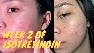 2 WEEKS AFTER TAKING ISOTRETINOIN Real updates  Purging is REAL pa rin [upl. by Balough]