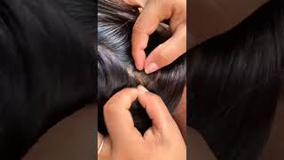 REMOVALS HUNDREDS OF LICE FROM BLACK HAIR hair lice hairstyle liceremoval hairlice liceremoval [upl. by Jessie]