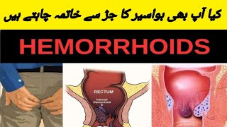 How To Get Rid Hemorrhoid [upl. by Notnad]