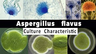 Aspergillus Flavus Culture Characteristic [upl. by Lenci]