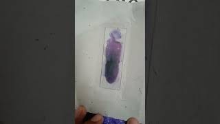 Peripheral Blood Smear for determining Differential Leucocyte count [upl. by Assenahs]