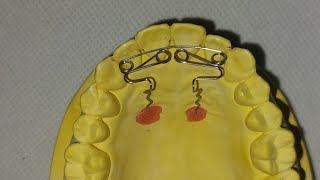 Orthodontic Wire Bending Recurved Z Spring [upl. by Ahsinej]