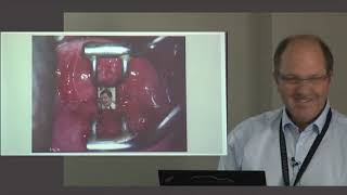 How to use the colposcope amp role of colposcopy in the modern world 1 [upl. by Gerick]