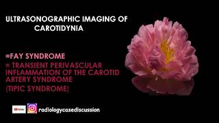 47ULTRASONOGRAPHIC IMAGING OF CAROTIDYNIA  FAY SYNDROME  TIPIC SYNDROM [upl. by Araf]