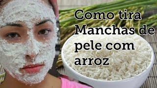 Como tirar manchas de pele sem gastar muito com Arroz [upl. by Magavern136]