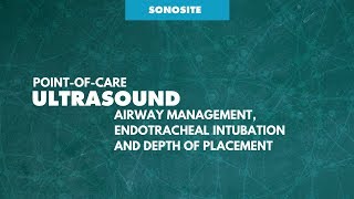 SonoSite Airway Webinar Dr Davinder Ramsingh [upl. by Caria]