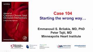 Case 104 Manual of CTO Interventions A rough start [upl. by Ken8]