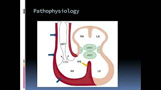 Cardiac Embryology The Key to Understanding Heart Development [upl. by Terle]