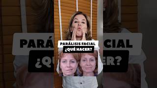 PARALISIS FACIAL ¿QUÉ HACER [upl. by Ymmit556]