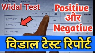 Widal Test Widal Test Positive Widal Test In Hindi Widal Test Report विडाल टेस्टWidaltestkaise [upl. by Nilreb]