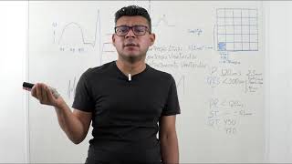 Interpretação de ECG [upl. by Anen]