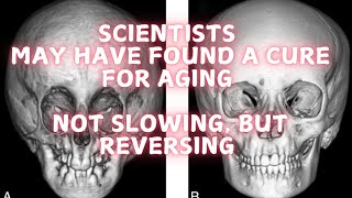 Scientists may have found a cure for aging [upl. by Brok]