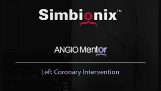 Coronary Angioplasty and Stenting Procedure on Simbionix ANGIO Mentor [upl. by Nodyarg]