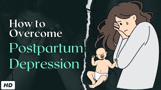 Postpartum Depression [upl. by Llenrac]