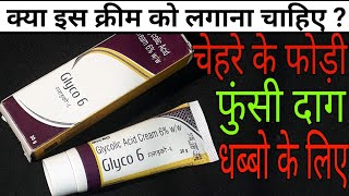 Glyco 6 Cream Review Hindi [upl. by Scevo]