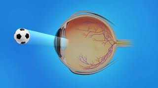 AgeRelated Macular Degeneration AMD Types Causes Symptoms Treatment [upl. by Diao]