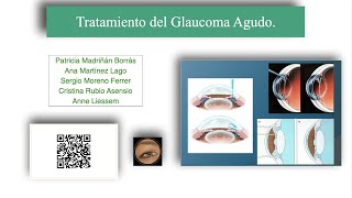 Tratamiento del Glaucoma Agudo [upl. by Macintyre]