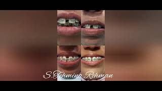 Life Changing Dentistry [upl. by Imuyam]