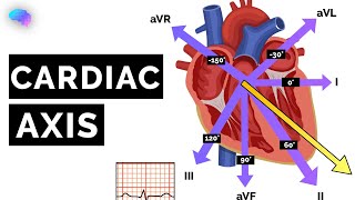 Cardiac Axis Explained  ECG  EKG  OSCE Guide  UKMLA  CPSA [upl. by Mariya810]