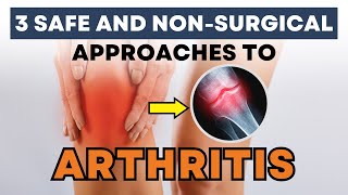 What Helps Arthritis in Knee Without Surgery 3 Proven NonSurgical Remedies [upl. by Rubens]