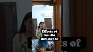 insulinresistance diabetesawareness insulinsensitivity healthtips girl shorts reels sugar [upl. by Llebpmac]