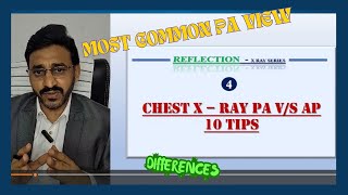 CHEST X RAY PA VS AP VIEW 10 DIFFERENCES  REFLECTION 4 [upl. by Enaej420]