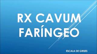 RADIOGRAFIA DE CAVUM FARINGEO [upl. by Tiffie]