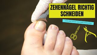 ZEHENNÄGEL RICHTIG SCHNEIDEN  So geht es richtig [upl. by Allerym]