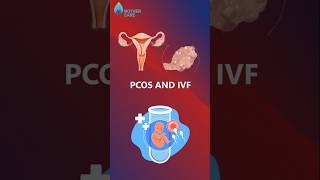 Is IVF Possible In PCOS  Dr Supriya Puranik ivfinpcos mothercare drsupriyapuranik ivf iui [upl. by Airdnaxila544]