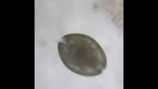 Tiny Aquarium Adventures Ostracod Moving Under Microscope [upl. by Ravaj204]