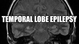 Temporal lobe epilepsy [upl. by Car807]