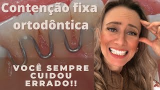 Você higieniza sua contenção errado😱 PRECISA saber disso aparelhoortodôntico aparelho [upl. by Molly]