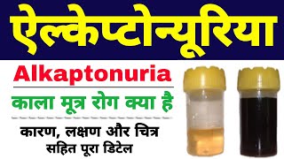 Alkaptonuria in hindi class 12 biology  black urine disease  ऐल्केप्टोन्यूरिया Biology ScienceSK [upl. by Noisla]