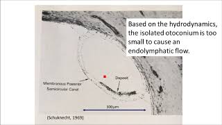 The etiology of BPPV microotoconia accumulation theory [upl. by Cai]