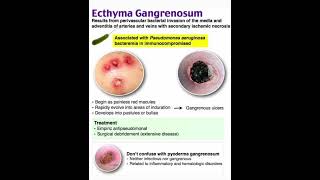 Ecthyma gangrenosum [upl. by Suiravaj594]