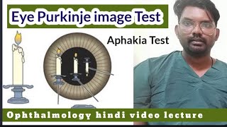 purkinje image test  purkinje image test in eye  purkinje image  ophthalmologyhindivideo [upl. by Siseneg186]