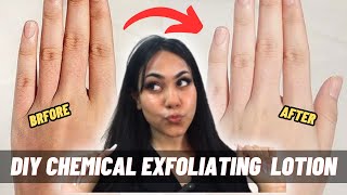 DIY Chemical Exfoliating Lotion  Shamaim Rajpoot [upl. by Eusassilem638]