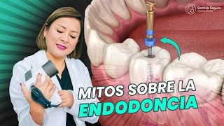 ¡Desmintiendo Mitos de la Endodoncia Todo lo Que Necesitas Saber [upl. by Einnod]