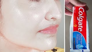 Most Amazing Toothpaste Life Hacks and Beauty Hacks [upl. by Priscella]