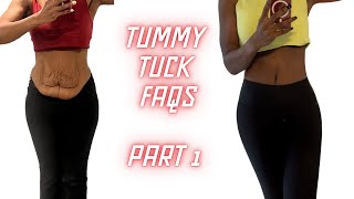 Tummy Tuck Recovery QuestionsAnswered  Cost Pain amp More [upl. by Elmaleh796]