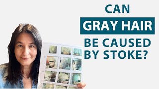 Can Gray Hair be Caused by a Hemorrhagic Stroke — Proof of Gray Hair Reversal with Cerebrolysin [upl. by Allehc]