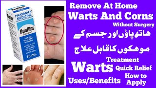 duofilm solution  duofilm solution how to use  solution  Best Solution For Warts Corns [upl. by Lauber250]